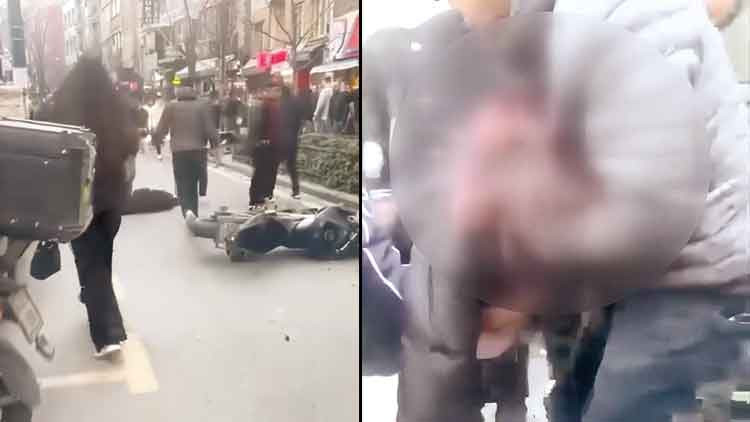 16&rsquo;lık S&uuml;r&uuml;c&uuml; Sorumsuzluğu! Yayaya &Ccedil;arpıp Ka&ccedil;tı