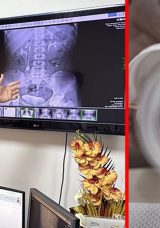 31 Yaşındaki Kadın Yıllarca Bu Ağrıyla Yaşadı! Ameliyata Giren Doktor Bile Şaşırdı