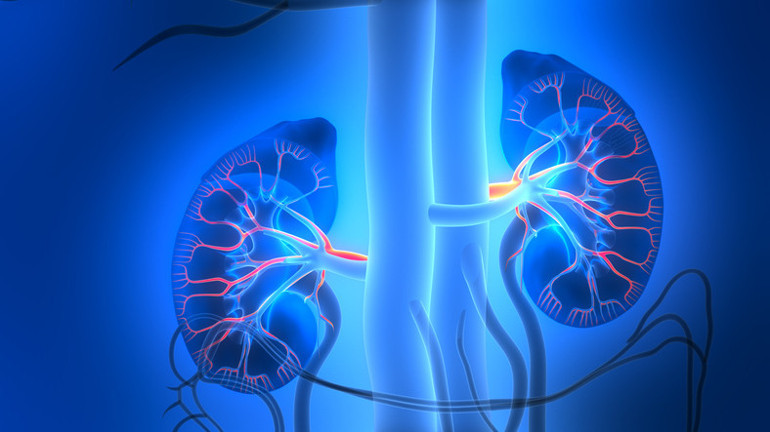 Böbrek Kanseri Belirtileri