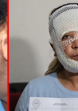 Adana&rsquo;da 'Prenses Cilt Bakımı' Kabusu Oldu! G&uuml;zellik Uğruna Hayatı Karardı: "&Ccedil;ocuğum &lsquo;&Ouml;c&uuml;&rsquo; Diyerek Benden Ka&ccedil;ıyor"