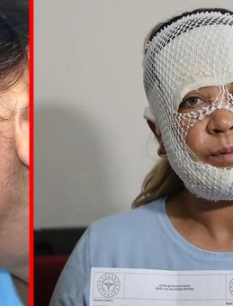 Adana&rsquo;da 'Prenses Cilt Bakımı' Kabusu Oldu! G&uuml;zellik Uğruna Hayatı Karardı: "&Ccedil;ocuğum &lsquo;&Ouml;c&uuml;&rsquo; Diyerek Benden Ka&ccedil;ıyor"