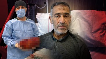 Ağrı şikayeti ile gitti, varılan teşhis doktorları da hayrete d&uuml;ş&uuml;rd&uuml; | Normalde yarım kilo olması gerekirken 8 kiloya ulaşmıştı