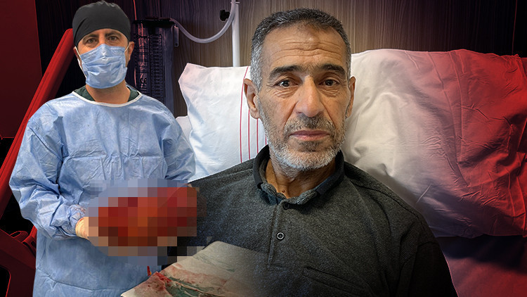 Ağrı şikayeti ile gitti, varılan teşhis doktorları da hayrete d&uuml;ş&uuml;rd&uuml; | Normalde yarım kilo olması gerekirken 8 kiloya ulaşmıştı