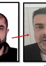 Ankara&rsquo;da Şaşkına &Ccedil;eviren Olay! Estetikle Kendini Kardeşine Benzetmeye &Ccedil;alışan Azmettirici Yakalandı
