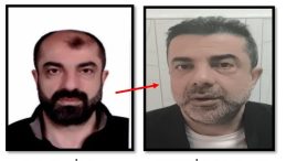 Ankara&rsquo;da Şaşkına &Ccedil;eviren Olay! Estetikle Kendini Kardeşine Benzetmeye &Ccedil;alışan Azmettirici Yakalandı