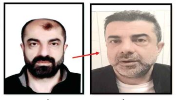 Azmettirici Ameliyatla Y&uuml;z&uuml;n&uuml; Değiştirmiş