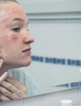 Bahar Geldi, Cilt Hastalıkları Patladı! İşte Nedeni