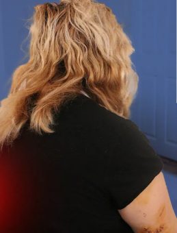 Diyarbakır&rsquo;da nikahlı eşini 30 yerinden bı&ccedil;aklamıştı! Talihsiz kadın dehşete d&uuml;ş&uuml;ren anları anlattı: Sırtımdan defalarca kez bı&ccedil;aklayıp&hellip;