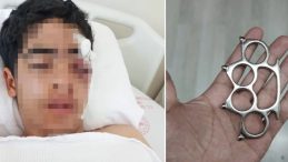 Esenyurt'ta Akran Şiddeti Hastanelik Etti! 15 Yaşındaki B&uuml;nyamin Muştalı Saldırıya Uğradı!