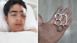 Esenyurt'ta dehşet! 15 yaşındaki &ccedil;ocuk 'Bana şaka yapma' dediği arkadaşı tarafından muştayla &ouml;ld&uuml;resiye d&ouml;v&uuml;ld&uuml;