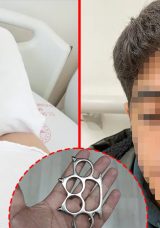 Esenyurt&rsquo;ta Akran Zorbalığı: 15 Yaşındaki &Ccedil;ocuğun G&ouml;z&uuml;n&uuml; Kaybetme Riski Var