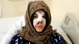Eşini feci şekilde darp etmişti… Savcıdan Kaldırım taşı silah sayılsın talebi