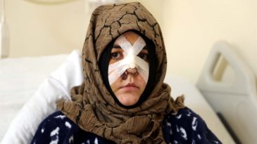 Eşini feci şekilde darp etmişti… Savcıdan Kaldırım taşı silah sayılsın talebi
