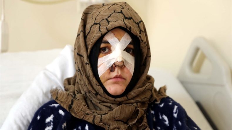 Eşini feci şekilde darp etmişti… Savcıdan Kaldırım taşı silah sayılsın talebi