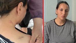 Eski eşi tarafından 17 bı&ccedil;ak darbesi alan kadın, &ouml;l&uuml; numarası yaparak kurtuldu
