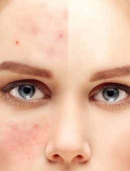 G&uuml;l Hastalığının 7 Kritik Belirtisi: Sizde Var mı?