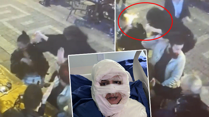 Kadık&ouml;y'deki dehşet! &Uuml;zerine kolonya d&ouml;kt&uuml;ğ&uuml; kadını yakmıştı… İlk kez hakim karşısına &ccedil;ıktı: 'Oraya gidince sa&ccedil;larını yakma istediği doğdu'