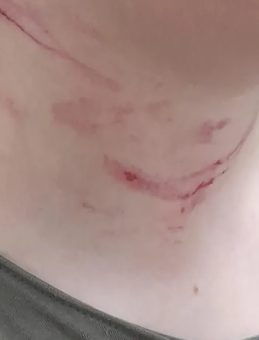 Ortaokulda dehşete düşüren akran zorbalığı: 8. sınıf öğrencisine acımasız darp!